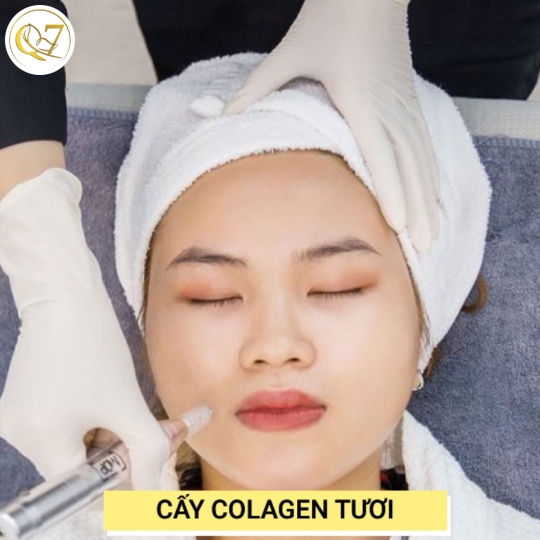 Cấy Colagen tươi