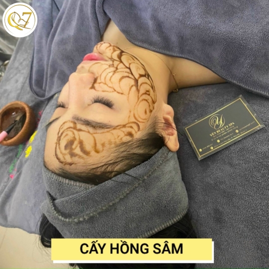 Cấy hồng sâm