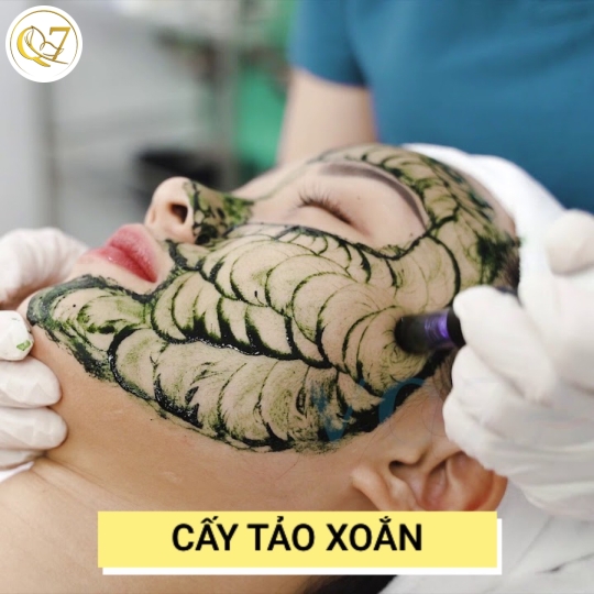 Cấy tảo xoắn 