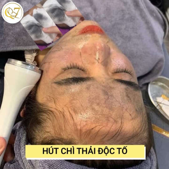 Hút Chì thải độc tố