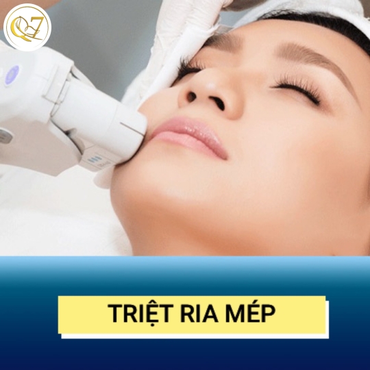 Triệt ria mép